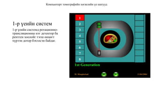 1-р үеийн систем
1-р үеийн системд ротационно-
трансляционны нэг детектор ба
рентген хоолойг тэгш өнцөгт
хүрээн дотор бэхэлсэн байдаг.
Компьютерт томографийн хөгжлийн үе шатууд
 