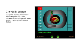 2-р үеийн систем
2-р үеийн системд ротационно-
трансляционны хэд хэдэн
детектор ба рентген хоолойг тэгш
өнцөгт хүрээн дотор бэхэлсэн
байдаг.
 