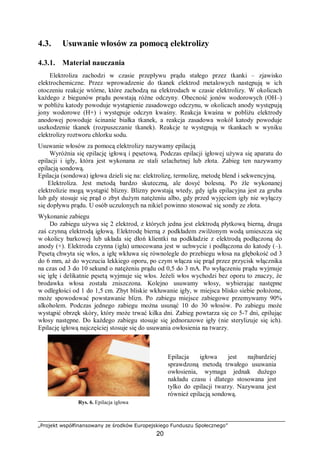 „Projekt współfinansowany ze środków Europejskiego Funduszu Społecznego”
20
4.3. Usuwanie włosów za pomocą elektrolizy
4.3.1. Materiał nauczania
Elektroliza zachodzi w czasie przepływu prądu stałego przez tkanki – zjawisko
elektrochemiczne. Przez wprowadzenie do tkanek elektrod metalowych następują w ich
otoczeniu reakcje wtórne, które zachodzą na elektrodach w czasie elektrolizy. W okolicach
każdego z biegunów prądu powstają różne odczyny. Obecność jonów wodorowych (OH–)
w pobliżu katody powoduje wystąpienie zasadowego odczynu, w okolicach anody występują
jony wodorowe (H+) i występuje odczyn kwaśny. Reakcja kwaśna w pobliżu elektrody
anodowej powoduje ścinanie białka tkanek, a reakcja zasadowa wokół katody powoduje
uszkodzenie tkanek (rozpuszczanie tkanek). Reakcje te występują w tkankach w wyniku
elektrolizy roztworu chlorku sodu.
Usuwanie włosów za pomocą elektrolizy nazywamy epilacją
Wyróżnia się epilację igłową i pęsetową. Podczas epilacji igłowej używa się aparatu do
epilacji i igły, która jest wykonana ze stali szlachetnej lub złota. Zabieg ten nazywamy
epilacją sondową.
Epilacja (sondowa) igłowa dzieli się na: elektrolizę, termolizę, metodę blend i sekwencyjną.
Elektroliza. Jest metodą bardzo skuteczną, ale dosyć bolesną. Po źle wykonanej
elektrolizie mogą wystąpić blizny. Blizny powstają wtedy, gdy igła epilacyjna jest za gruba
lub gdy stosuje się prąd o zbyt dużym natężeniu albo, gdy przed wyjęciem igły nie wyłączy
się dopływu prądu. U osób uczulonych na nikiel powinno stosować się sondy ze złota.
Wykonanie zabiegu
Do zabiegu używa się 2 elektrod, z których jedna jest elektrodą płytkową bierną, druga
zaś czynną elektrodą igłową. Elektrodę bierną z podkładem zwilżonym wodą umieszcza się
w okolicy barkowej lub układa się dłoń klientki na podkładzie z elektrodą podłączoną do
anody (+). Elektroda czynna (igła) umocowana jest w uchwycie i podłączona do katody (–).
Pęsetą chwyta się włos, a igłę wkłuwa się równolegle do przebiegu włosa na głębokość od 3
do 6 mm, aż do wyczucia lekkiego oporu, po czym włącza się prąd przez przycisk włącznika
na czas od 3 do 10 sekund o natężeniu prądu od 0,5 do 3 mA. Po wyłączeniu prądu wyjmuje
się igłę i delikatnie pęsetą wyjmuje się włos. Jeżeli włos wychodzi bez oporu to znaczy, że
brodawka włosa została zniszczona. Kolejno usuwamy włosy, wybierając następne
w odległości od 1 do 1,5 cm. Zbyt bliskie wkłuwanie igły, w miejsca blisko siebie położone,
może spowodować powstawanie blizn. Po zabiegu miejsce zabiegowe przemywamy 90%
alkoholem. Podczas jednego zabiegu można usunąć 10 do 30 włosów. Po zabiegu może
wystąpić obrzęk skóry, który może trwać kilka dni. Zabieg powtarza się co 5-7 dni, epilując
włosy następne. Do każdego zabiegu stosuje się jednorazowe igły (nie sterylizuje się ich).
Epilację igłową najczęściej stosuje się do usuwania owłosienia na twarzy.
Rys. 6. Epilacja igłowa
Epilacja igłowa jest najbardziej
sprawdzoną metodą trwałego usuwania
owłosienia, wymaga jednak dużego
nakładu czasu i dlatego stosowana jest
tylko do epilacji twarzy. Nazywana jest
również epilacją sondową.
 