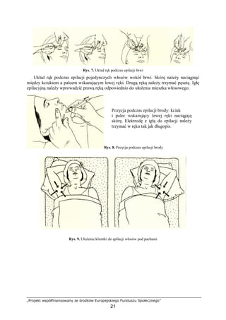„Projekt współfinansowany ze środków Europejskiego Funduszu Społecznego”
21
Rys. 7. Układ rąk podczas epilacji brwi
Układ rąk podczas epilacji pojedynczych włosów wokół brwi. Skórę należy naciągnąć
między kciukiem a palcem wskazującym lewej ręki. Drugą ręką należy trzymać pęsetę. Igłę
epilacyjną należy wprowadzić prawą ręką odpowiednio do ułożenia mieszka włosowego.
Rys. 8. Pozycja podczas epilacji brody
Rys. 9. Ułożenie klientki do epilacji włosów pod pachami
Pozycja podczas epilacji brody: kciuk
i palec wskazujący lewej ręki naciągają
skórę. Elektrodę z igłą do epilacji należy
trzymać w ręku tak jak długopis.
 