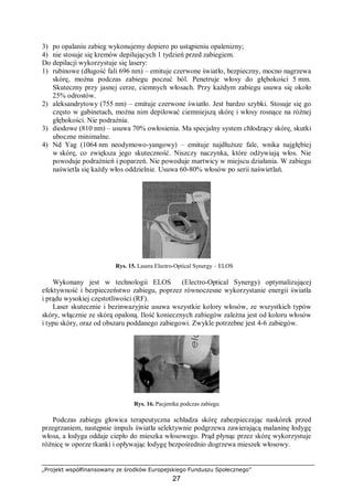 „Projekt współfinansowany ze środków Europejskiego Funduszu Społecznego”
27
3) po opalaniu zabieg wykonujemy dopiero po ustąpieniu opalenizny;
4) nie stosuje się kremów depilujących 1 tydzień przed zabiegiem.
Do depilacji wykorzystuje się lasery:
1) rubinowe (długość fali 696 nm) – emituje czerwone światło, bezpieczny, mocno nagrzewa
skórę, można podczas zabiegu poczuć ból. Penetruje włosy do głębokości 5 mm.
Skuteczny przy jasnej cerze, ciemnych włosach. Przy każdym zabiegu usuwa się około
25% odrostów.
2) aleksandrytowy (755 nm) – emituje czerwone światło. Jest bardzo szybki. Stosuje się go
często w gabinetach, można nim depilować ciemniejszą skórę i włosy rosnące na różnej
głębokości. Nie podrażnia.
3) diodowe (810 nm) – usuwa 70% owłosienia. Ma specjalny system chłodzący skórę, skutki
uboczne minimalne.
4) Nd Yag (1064 nm neodymowo-yangowy) – emituje najdłuższe fale, wnika najgłębiej
w skórę, co zwiększa jego skuteczność. Niszczy naczynka, które odżywiają włos. Nie
powoduje podrażnień i poparzeń. Nie powoduje martwicy w miejscu działania. W zabiegu
naświetla się każdy włos oddzielnie. Usuwa 60-80% włosów po serii naświetlań.
Rys. 15. Lasera Electro-Optical Synergy – ELOS™
Wykonany jest w technologii ELOS™ (Electro-Optical Synergy) optymalizującej
efektywność i bezpieczeństwo zabiegu, poprzez równoczesne wykorzystanie energii światła
i prądu wysokiej częstotliwości (RF).
Laser skutecznie i bezinwazyjnie usuwa wszystkie kolory włosów, ze wszystkich typów
skóry, włącznie ze skórą opaloną. Ilość koniecznych zabiegów zależna jest od koloru włosów
i typu skóry, oraz od obszaru poddanego zabiegowi. Zwykle potrzebne jest 4-6 zabiegów.
Rys. 16. Pacjentka podczas zabiegu
Podczas zabiegu głowica terapeutyczna schładza skórę zabezpieczając naskórek przed
przegrzaniem, następnie impuls światła selektywnie podgrzewa zawierającą malaninę łodygę
włosa, a łodyga oddaje ciepło do mieszka włosowego. Prąd płynąc przez skórę wykorzystuje
różnicę w oporze tkanki i opływając łodygę bezpośrednio dogrzewa mieszek włosowy.
 