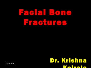 Facial Bone
Fractures
Dr. Krishna22/08/201622/08/2016
 