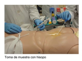 Toma de muestra con hisopo
 