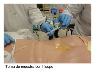 Toma de muestra con hisopo
 