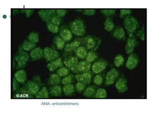 ANA- anticentrômero
 