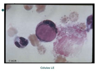 Células LE
 