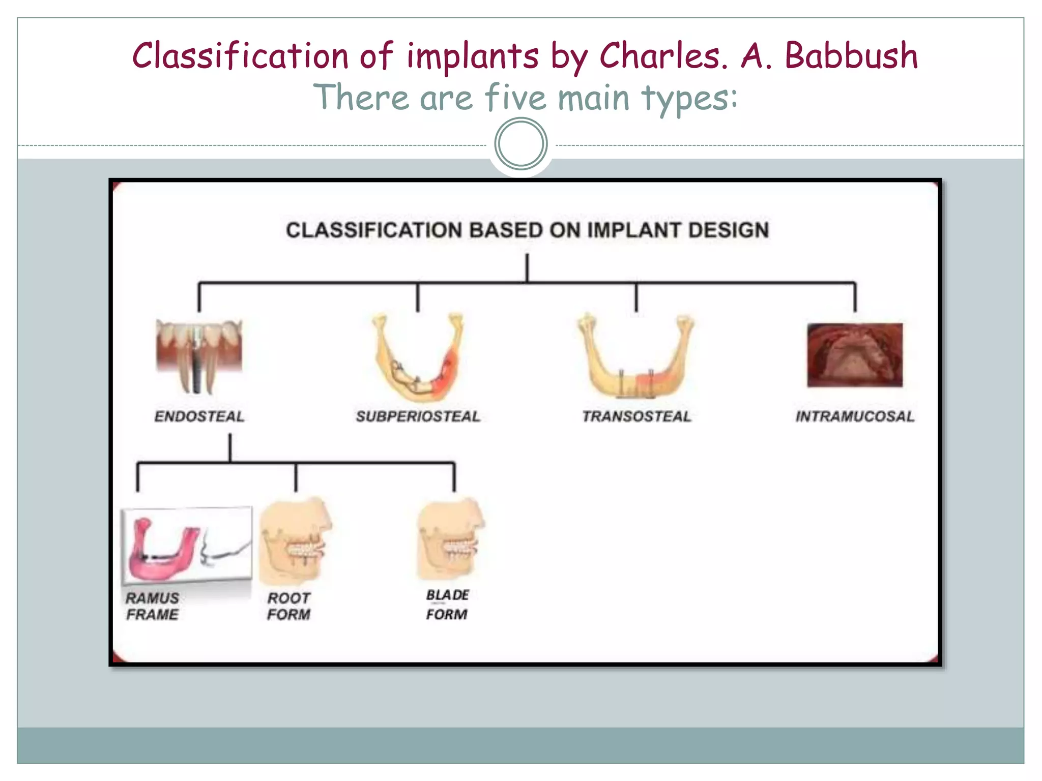 Basic aspects of implants | PPTX