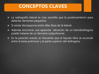  La radiografía lateral es mas sensible que la posteroanterior para
detectar derrames pequeños.
 Si existe discrepancia entre ellas fíese de la lateral.
 Además encontrar una aparente elevación de un hemidriafragma
puede tratarse de un derrame subpulmonar.
 En la posición erecta, es frecuente que el liquido libre se acumule
entre la base pulmonar y la parte superior del diafragma.
CONCEPTOS CLAVES
 