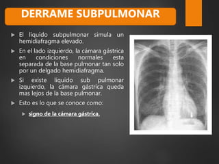  El liquido subpulmonar simula un
hemidiafragma elevado.
 En el lado izquierdo, la cámara gástrica
en condiciones normales esta
separada de la base pulmonar tan solo
por un delgado hemidiafragma.
 Si existe liquido sub pulmonar
izquierdo, la cámara gástrica queda
mas lejos de la base pulmonar.
 Esto es lo que se conoce como:
 signo de la cámara gástrica.
DERRAME SUBPULMONAR
 