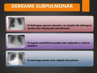.
• El diafragma aparece elevado y la cúspide del diafragma
puede estar desplazada lateralmente.
.
• El ángulo costofrénico puede estar aplanado o mostrar
menisco.
.
• El estomago puede estar alejado del pulmón.
DERRAME SUBPULMONAR
 