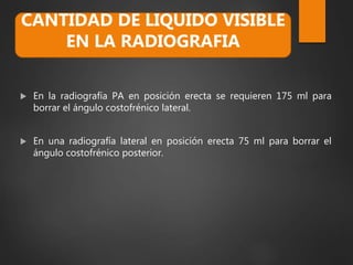  En la radiografía PA en posición erecta se requieren 175 ml para
borrar el ángulo costofrénico lateral.
 En una radiografía lateral en posición erecta 75 ml para borrar el
ángulo costofrénico posterior.
CANTIDAD DE LIQUIDO VISIBLE
EN LA RADIOGRAFIA
 