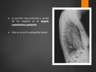  La porción mas profunda y caudal
de los ángulos es el ángulo
costofrénico posterior.
 Solo se ve en la radiografía lateral.
 