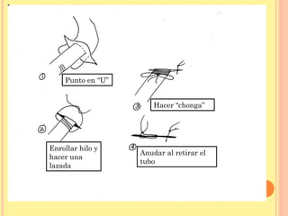 Enrollar hilo y
hacer una
lazada
Punto en “U”
Hacer “chonga”
Anudar al retirar el
tubo
 