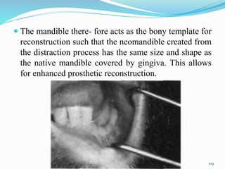  The mandible there- fore acts as the bony template for
reconstruction such that the neomandible created from
the distraction process has the same size and shape as
the native mandible covered by gingiva. This allows
for enhanced prosthetic reconstruction.
109
 