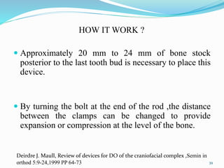 HOW IT WORK ?
 Approximately 20 mm to 24 mm of bone stock
posterior to the last tooth bud is necessary to place this
device.
 By turning the bolt at the end of the rod ,the distance
between the clamps can be changed to provide
expansion or compression at the level of the bone.
39
Deirdre J. Maull, Review of devices for DO of the craniofacial complex ,Semin in
orthod 5:9-24,1999 PP 64-73
 