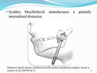  Synthes Maxillofacial manufactures a partially
internalized distractor.
48
Deirdre J. Maull, Review of devices for DO of the craniofacial complex ,Semin in
orthod 5:9-24,1999 PP 64-73
 