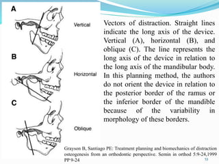  Vectors of distraction. Straight lines
indicate the long axis of the device.
Vertical (A), horizontal (B), and
oblique (C). The line represents the
long axis of the device in relation to
the long axis of the mandibular body.
In this planning method, the authors
do not orient the device in relation to
the posterior border of the ramus or
the inferior border of the mandible
because of the variability in
morphology of these borders.
53
Grayson B, Santiago PE: Treatment planning and biomechanics of distraction
osteogenesis from an orthodontic perspective. Semin in orthod 5:9-24,1999
PP 9-24
 