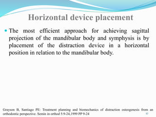 Horizontal device placement
 The most efficient approach for achieving sagittal
projection of the mandibular body and symphysis is by
placement of the distraction device in a horizontal
position in relation to the mandibular body.
57
Grayson B, Santiago PE: Treatment planning and biomechanics of distraction osteogenesis from an
orthodontic perspective. Semin in orthod 5:9-24,1999 PP 9-24
 