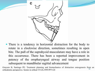  There is a tendency in horizontal distraction for the body to
rotate in a clockwise direction, sometimes resulting in open
bite. The pull of the suprahyoid musculature may have a role in
this occurrence. There has been a reported improvement in
patency of the oropharyngeal airway and tongue position
subsequent to mandibular sagittal advancement
59
Grayson B, Santiago PE: Treatment planning and biomechanics of distraction osteogenesis from an
orthodontic perspective. Semin in orthod 5:9-24,1999 PP 9-24
 
