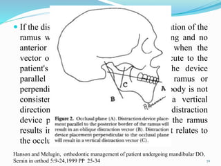  If the distraction goal is pure vertical elongation of the
ramus with unilateral posterior bite opening and no
anterior movement, this is best realized when the
vector of distraction is perpendicular or acute to the
patient's occlusal plane. Placement of the device
parallel to the posterior border of the ramus or
perpendicular to the inferior border of the body is not
consistent with the goal of achieving a vertical
direction of distraction. Placement of the distraction
device parallel to the posterior border of the ramus
results in an oblique distraction vector as it relates to
the occlusion.
72
Hanson and Melugin, orthodontic management of patient undergoing mandibular DO,
Semin in orthod 5:9-24,1999 PP 25-34
 