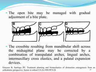 • The open bite may be managed with gradual
adjustment of a bite plate.
• The crossbite resulting from mandibular shift across
the midsagittal plane may be corrected by a
combination of transpalatal arches, lingual arches,
intermaxillary cross elastics, and a palatal expansion
devices.
78
Grayson B, Santiago PE: Treatment planning and biomechanics of distraction osteogenesis from an
orthodontic perspective. Semin in orthod 5:9-24,1999 PP 9-24
 