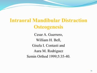 Intraoral Mandibular Distraction
Osteogenesis
Cesar A. Guerrero,
William H. Bell,
Gisela I. Contasti and
Aura M. Rodriguez
Semin Orthod 1999;5:35-40.
79
 