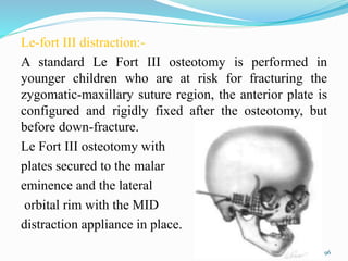 Le-fort III distraction:-
A standard Le Fort III osteotomy is performed in
younger children who are at risk for fracturing the
zygomatic-maxillary suture region, the anterior plate is
configured and rigidly fixed after the osteotomy, but
before down-fracture.
Le Fort III osteotomy with
plates secured to the malar
eminence and the lateral
orbital rim with the MID
distraction appliance in place.
96
 