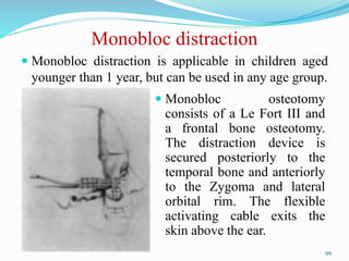 Monobloc distraction
 Monobloc distraction is applicable in children aged
younger than 1 year, but can be used in any age group.
 Monobloc osteotomy
consists of a Le Fort III and
a frontal bone osteotomy.
The distraction device is
secured posteriorly to the
temporal bone and anteriorly
to the Zygoma and lateral
orbital rim. The flexible
activating cable exits the
skin above the ear.
99
 