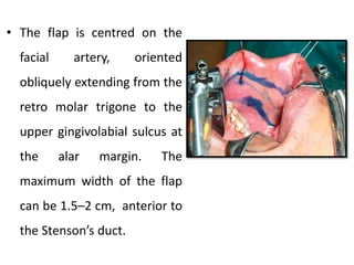• The flap is centred on the
facial artery, oriented
obliquely extending from the
retro molar trigone to the
upper gingivolabial sulcus at
the alar margin. The
maximum width of the flap
can be 1.5–2 cm, anterior to
the Stenson’s duct.
 