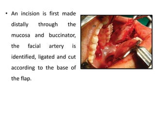 • An incision is first made
distally through the
mucosa and buccinator,
the facial artery is
identified, ligated and cut
according to the base of
the flap.
 