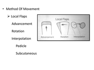 • Method Of Movement
 Local Flaps
Advancement
Rotation
Interpolation
Pedicle
Subcutaneous
 