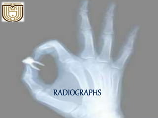 RADIOGRAPHS
 