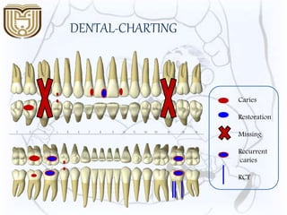 Caries
Restoration
Missing
Recurrent
caries
RCT
DENTAL-CHARTING
 