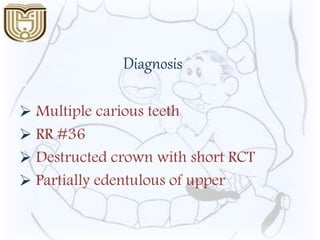 Diagnosis
 Multiple carious teeth
 RR #36
 Destructed crown with short RCT
 Partially edentulous of upper
 