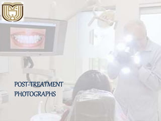 POST-TREATMENT
PHOTOGRAPHS
 