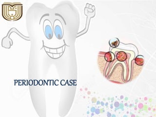 PERIODONTIC CASE
 