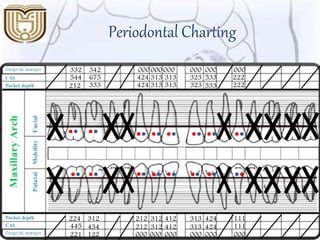 Periodontal Charting
212 323333 424 313 313 533 222
544
332
675
342
424
000
313
000
313
000
323
000
533
000
222
000
111
111
000000000
313
313
424
424412312212
212
000 000
312
000
412
122
434
312
221
445
224
 
