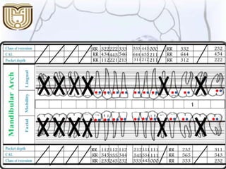 311
543
232443000
111
111
554
111112 212112
355
243 333
545
232233
112
RR
RR
RR 232
565
333
RR
RR
RR
345 344
232
454
222212211
211
000
655
443333 333222
443
221 311
644
213112
322
RR
RR
RR 332
644
312
RR
RR
RR
434 546
 
