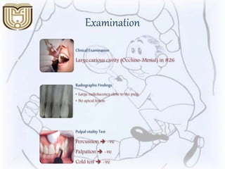 Examination
Clinical Examination
Large carious cavity (Occluso-Mesial) in #26
RadiographicFindings
• Large radiolucency close to the pulp
• No apical lesion
Pulpalvitality Test
Percussion  -ve
Palpation  -ve
Cold test  -ve
 