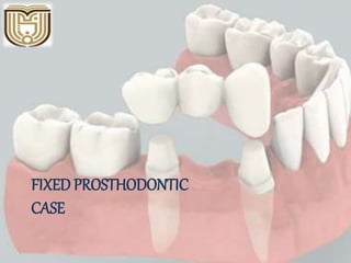 FIXED PROSTHODONTIC
CASE
 