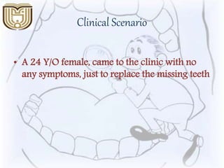 Clinical Scenario
• A 24 Y/O female, came to the clinic with no
any symptoms, just to replace the missing teeth
 