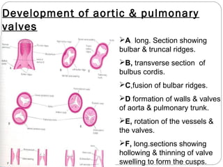 Development of aortic & pulmonary
valves
A, long. Section showing
bulbar & truncal ridges.
B, transverse section of
bulbus cordis.
C,fusion of bulbar ridges.
D,formation of walls & valves
of aorta & pulmonary trunk.
E, rotation of the vessels &
the valves.
F, long.sections showing
hollowing & thinning of valve
swelling to form the cusps.

 
