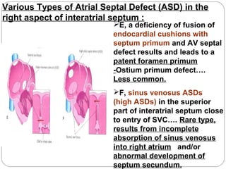 Various Types of Atrial Septal Defect (ASD) in the
right aspect of interatrial septum :

E, a deficiency of fusion of
endocardial cushions with
septum primum and AV septal
defect results and leads to a
patent foramen primum
-Ostium primum defect….
Less common.
F, sinus venosus ASDs
(high ASDs) in the superior
part of interatrial septum close
to entry of SVC…. Rare type,
results from incomplete
absorption of sinus venosus
into right atrium and/or
abnormal development of
septum secundum.

 