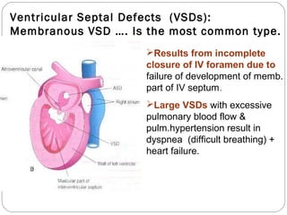 Ventricular Septal Defects (VSDs):
Membranous VSD …. Is the most common type.
Results from incomplete
closure of IV foramen due to
failure of development of memb.
part of IV septum.
Large VSDs with excessive
pulmonary blood flow &
pulm.hypertension result in
dyspnea (difficult breathing) +
heart failure.

 