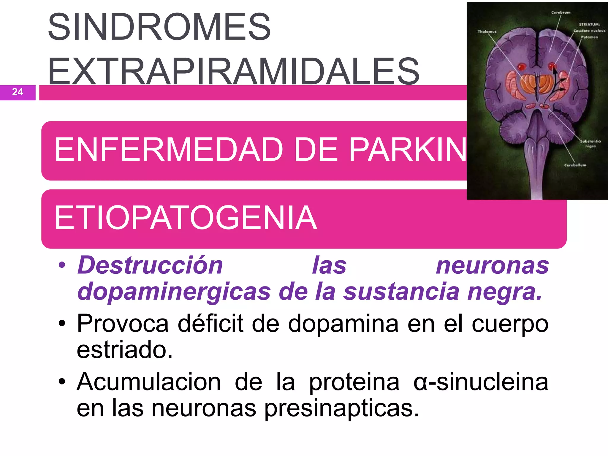 ENFERMEDAD DE PARKINSON.
ETIOPATOGENIA
• Destrucción las neuronas
dopaminergicas de la sustancia negra.
• Provoca déficit de dopamina en el cuerpo
estriado.
• Acumulacion de la proteina α-sinucleina
en las neuronas presinapticas.
SINDROMES
EXTRAPIRAMIDALES24
 