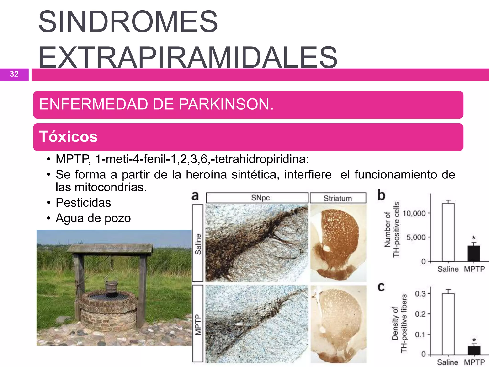ENFERMEDAD DE PARKINSON.
Tóxicos
• MPTP, 1-meti-4-fenil-1,2,3,6,-tetrahidropiridina:
• Se forma a partir de la heroína sintética, interfiere el funcionamiento de
las mitocondrias.
• Pesticidas
• Agua de pozo
SINDROMES
EXTRAPIRAMIDALES32
 
