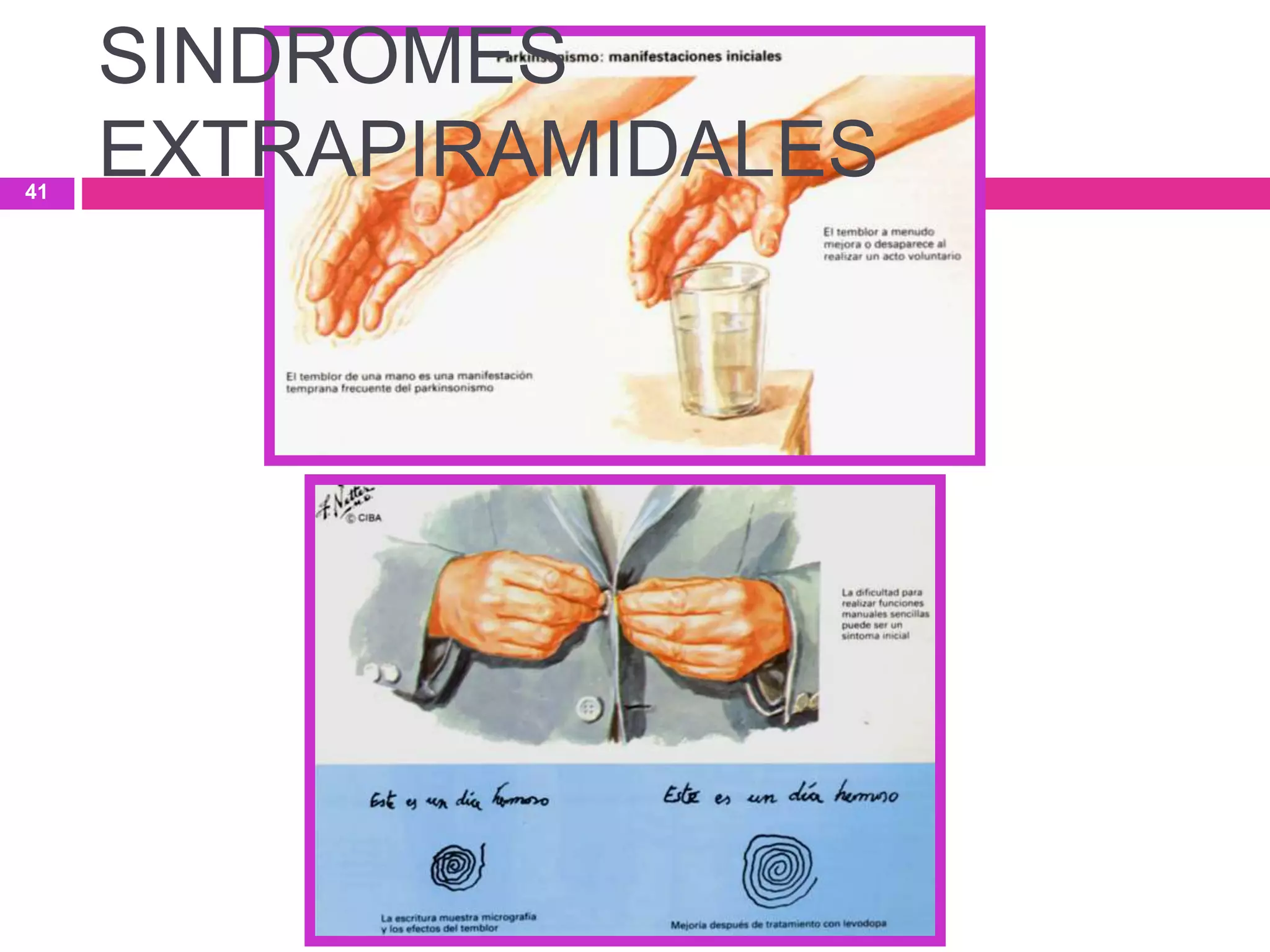 SINDROMES
EXTRAPIRAMIDALES41
 