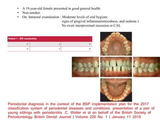 classification of periodontal diseases-includes 2017 | PPTX