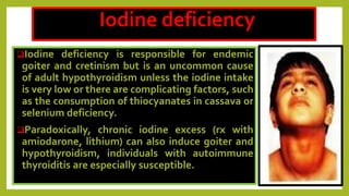 Iodine deficiency
Iodine deficiency is responsible for endemic
goiter and cretinism but is an uncommon cause
of adult hypothyroidism unless the iodine intake
is very low or there are complicating factors, such
as the consumption of thiocyanates in cassava or
selenium deficiency.
Paradoxically, chronic iodine excess (rx with
amiodarone, lithium) can also induce goiter and
hypothyroidism, individuals with autoimmune
thyroiditis are especially susceptible.
 