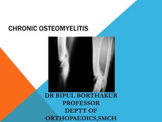 CHRONIC OSTEOMYELITIS
DR BIPUL BORTHAKUR
PROFESSOR
DEPTT OF
ORTHOPAEDICS,SMCH
 